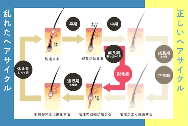 【スカルプケアのプロが監修】LAMINAS(ラミナス)の口コミ・評判から分かる実力【女性用育毛剤】
