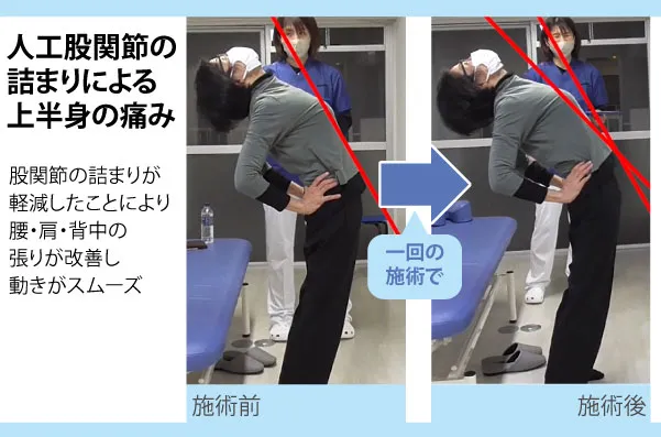 【口コミ・評判】整体に通い続けるのはもう終わり?「セルフケア整体」で6回改善を目指す新常識