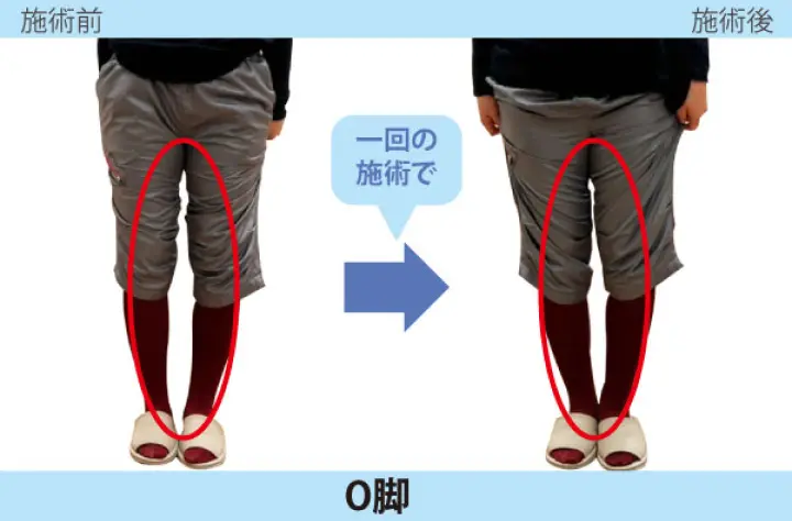 【口コミ・評判】整体に通い続けるのはもう終わり?「セルフケア整体」で6回改善を目指す新常識