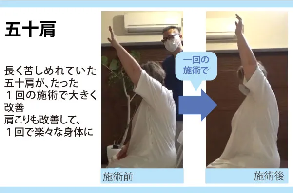 【口コミ・評判】整体に通い続けるのはもう終わり?「セルフケア整体」で6回改善を目指す新常識
