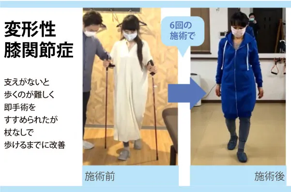 【口コミ・評判】整体に通い続けるのはもう終わり?「セルフケア整体」で6回改善を目指す新常識