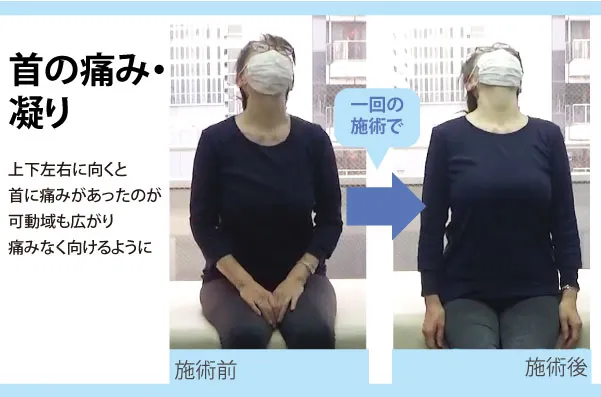 【口コミ・評判】整体に通い続けるのはもう終わり?「セルフケア整体」で6回改善を目指す新常識