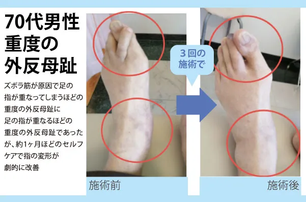 【口コミ・評判】整体に通い続けるのはもう終わり?「セルフケア整体」で6回改善を目指す新常識