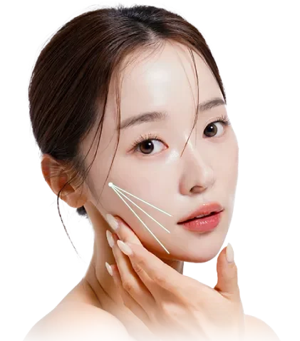 【口コミ・評判】糸リフトならエルムクリニック！エルムリフトの特徴と選ばれる3つの理由