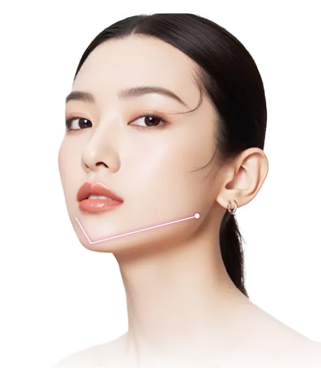 【口コミ・評判】糸リフトならエルムクリニック！エルムリフトの特徴と選ばれる3つの理由