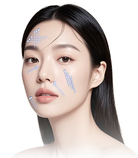 【口コミ・評判】糸リフトならエルムクリニック！エルムリフトの特徴と選ばれる3つの理由