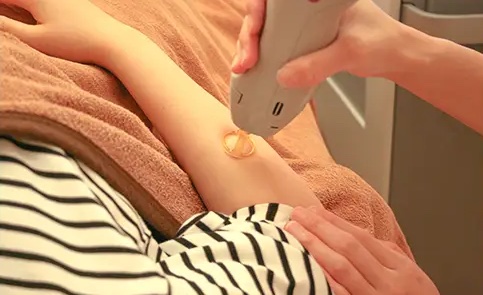 【口コミ・評判】カルミア美肌クリニックの医療脱毛は本当に安心？女性専用・満足度92.4％の理由