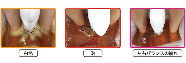 【口コミ・評判】GOD-CLEANER・GOLD（ゴッドクリーナーゴールド）とは？サロン集客・差別化につながるデトックスマシンを徹底解説